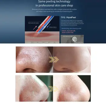 2022 NOVO Portátil Mini Hydra Dermoabrasão Máquina Facial oxigênio W/LED Beleza de acne Cravo Espinha Removedor de Sucção Limpeza dos Poros 2