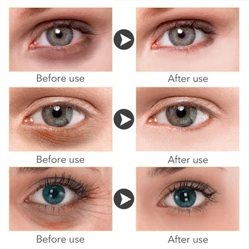 5PCS Remover olheiras Soro Sacos de Olho Elevador Empresa de Branqueamento de Creme de Ácido Hialurônico Anti-Rugas Massagem Anti Envelhecimento Olhos de Cuidados 2